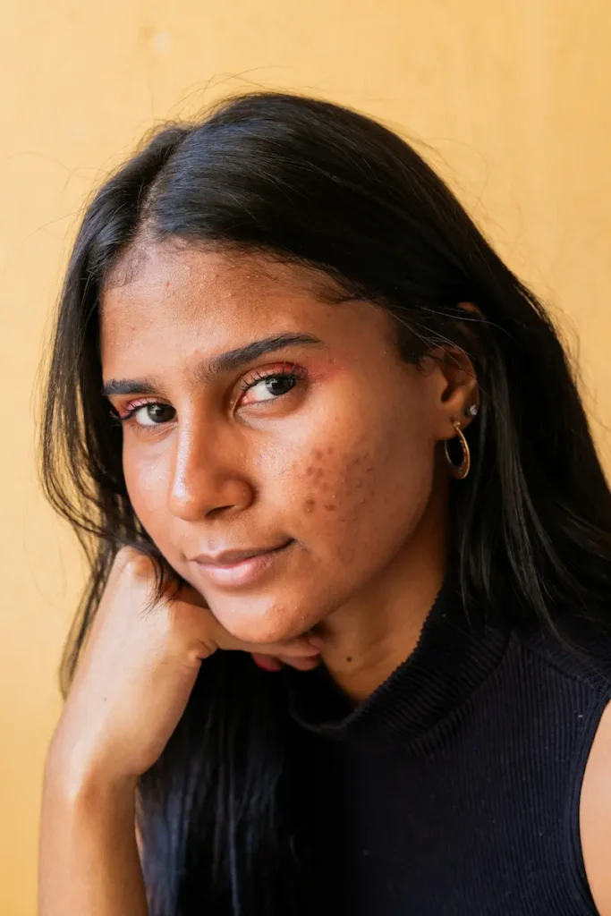 Everyday habits like touching your face, diet, and skincare mistakes that can cause acne