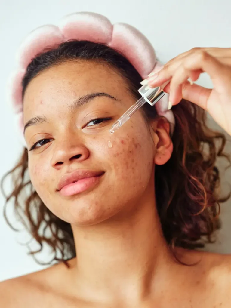 simple skincare routine for acne-prone skin steps